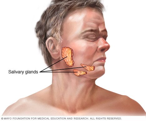 Mumps Disease Reference Guide Drugs Com